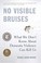 Go to record No visible bruises : what we don't know about domestic vio...